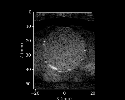 Doppler B-mode Animation
