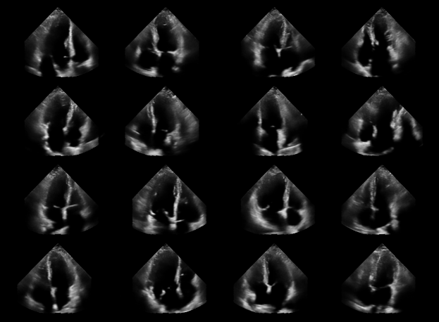../../_images/notebooks_models_diffusion_model_example_13_0.png