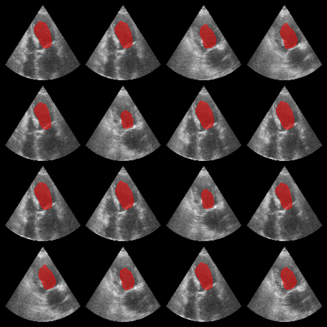 ../../_images/notebooks_models_segmentation_example_10_1.png