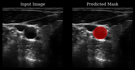 ../../_images/notebooks_models_segmentation_example_13_0.png