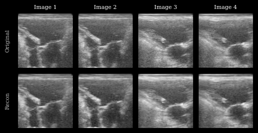 ../../_images/notebooks_models_taesd_autoencoder_example_14_0.png